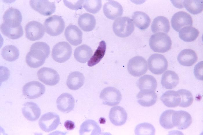 This thin film blood smear micrograph depicts a Plasmodium falciparum parasite microgametocyte. The Plasmodium falciparum gametocyte is crescent- or sausage-shaped, with a single mass of chromatin, called a macrogametocyte, or, as in this instance, diffuse chromatin which surrounds a dark pigmented mass know as a microgametocyte.