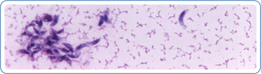 CDC Home
Parasites - Toxoplasmosis (Toxoplasma infection)