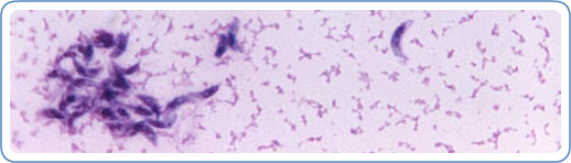 CDC Home
Parasites - Toxoplasmosis (Toxoplasma infection)